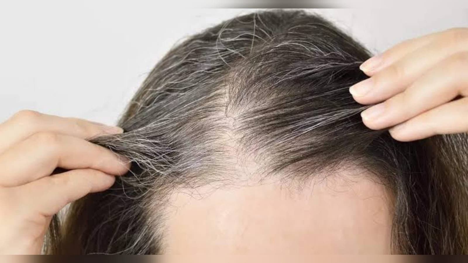  2 kg human hair found in Uttar Pradesh womans stomach_gnr
