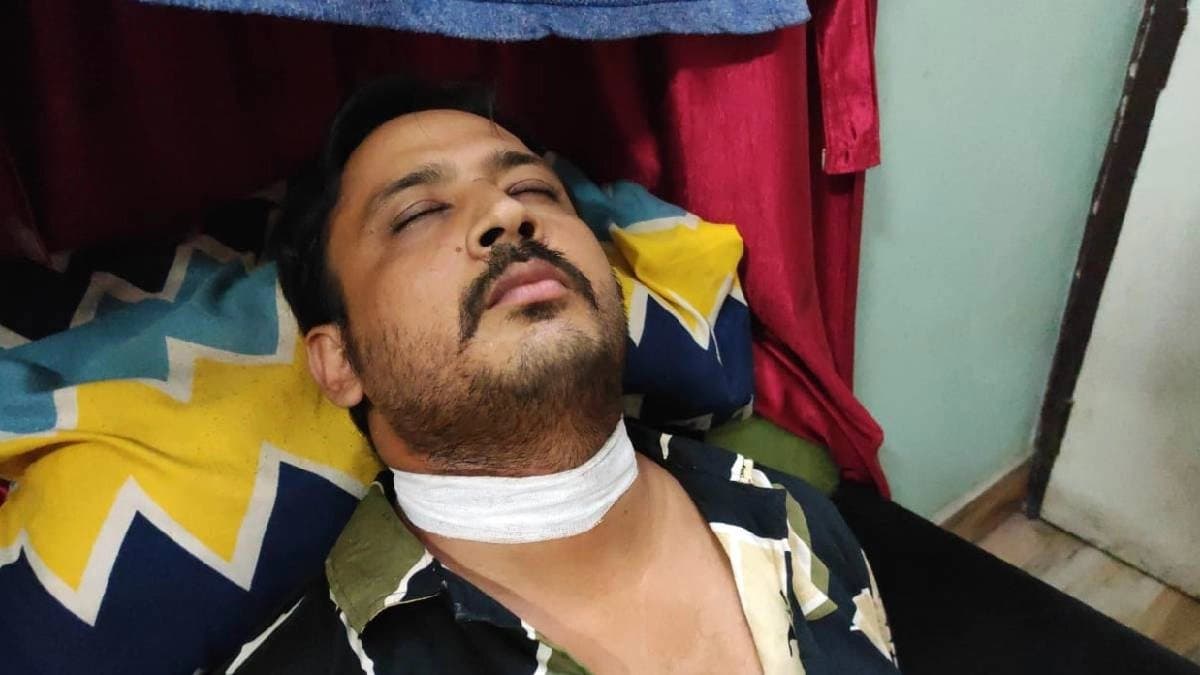  A Man And His Son Got Heavily Injured with a Chinese Thread 