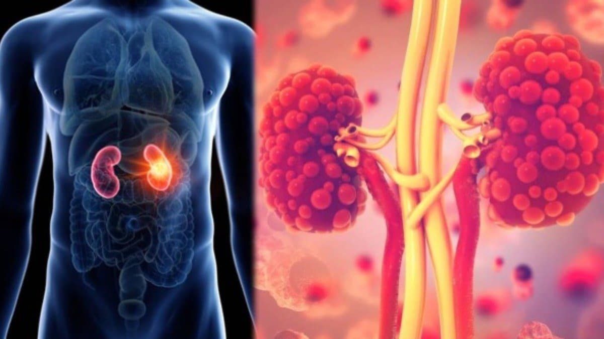  these warning signs of kidney disease appear at night that should not be ignored