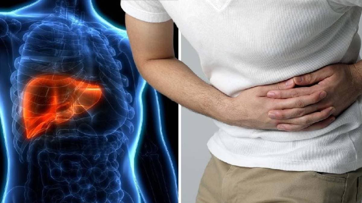  Not just alcohol these Common Drinks damage Liver and can turn fatty liver into cirrhosis