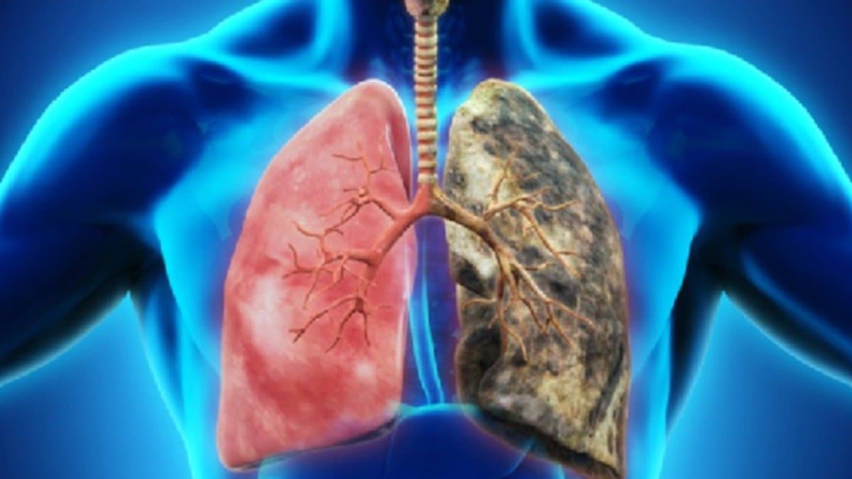  These five cheap foods will remove all dirt from lungs instantly 
