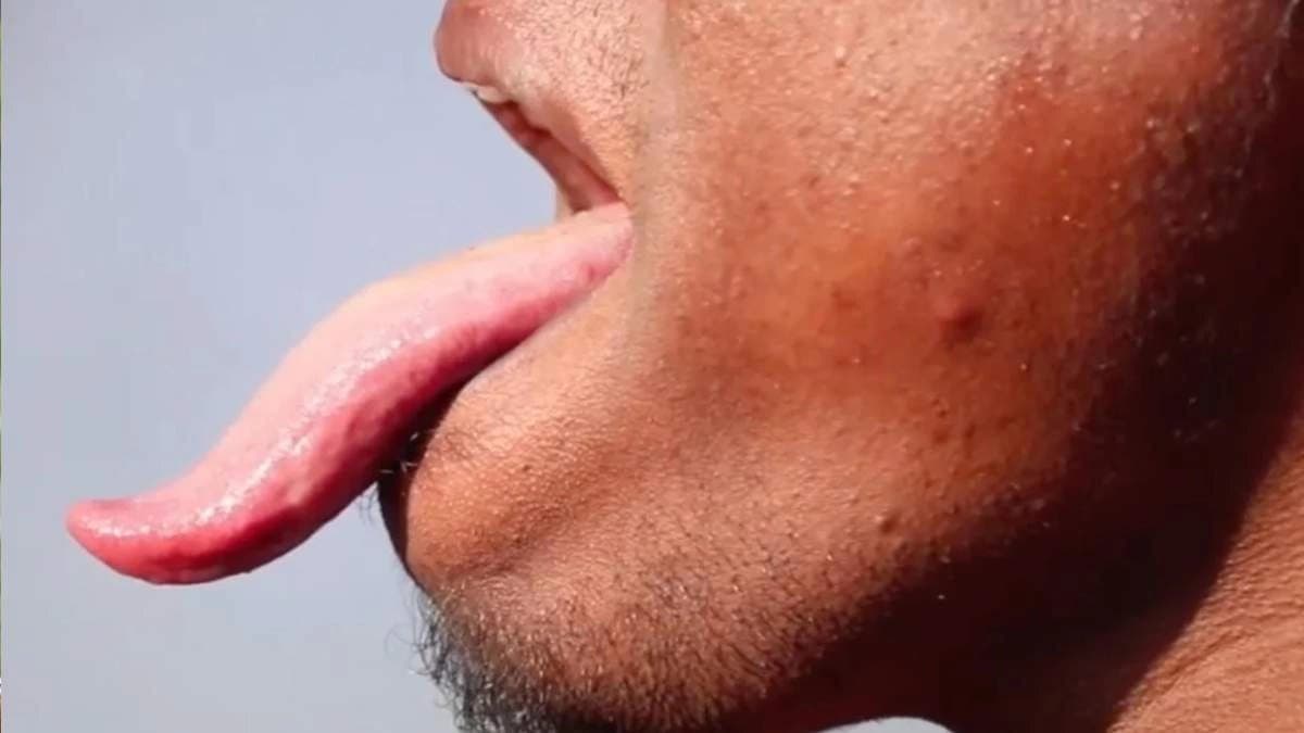 Wife bits husband s tongue after argument got heated in a Bizarre Incident
