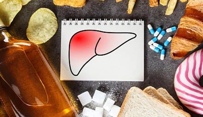 Healthy Lifestyle:  সাবধান! এই সব খাবারে বাড়তে পারে ফ্যাটি লিভারের ঝুঁকি, দাবি চিকিৎসকের