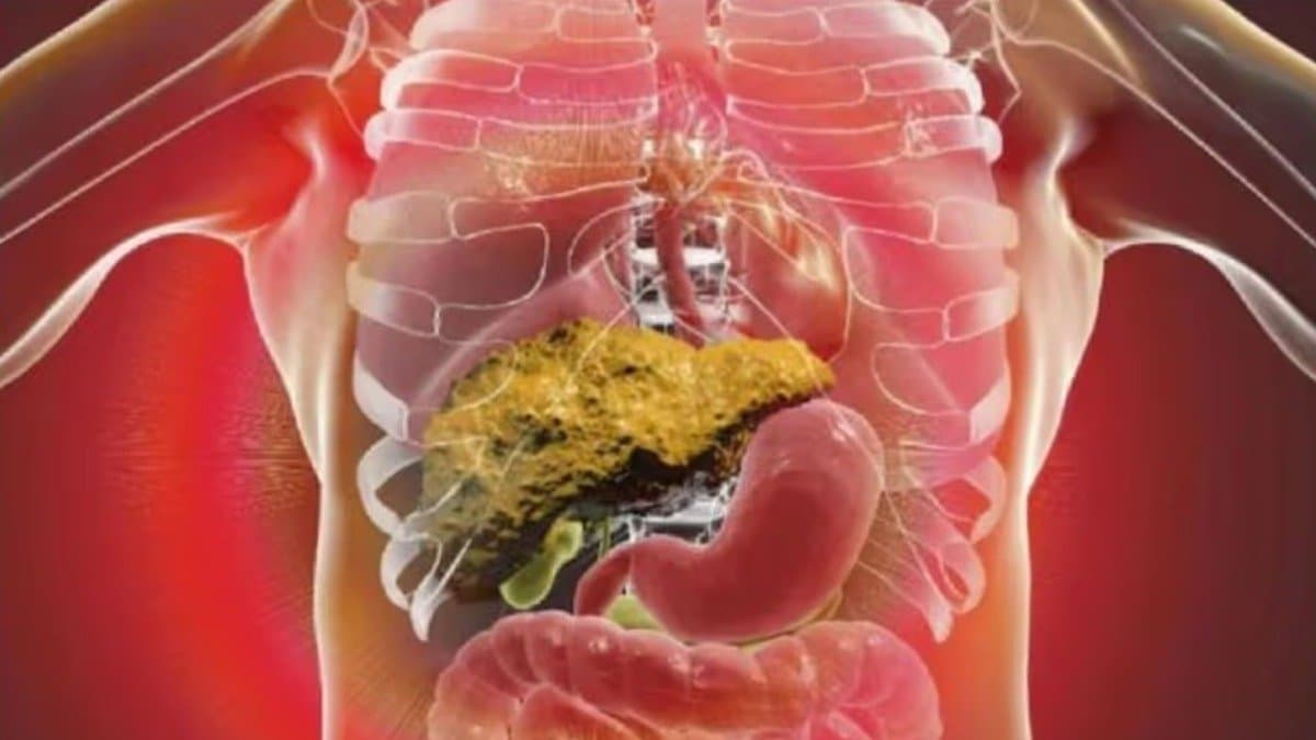 Liver Disease Symptoms: These early signs of Liver Disease are easily ignored