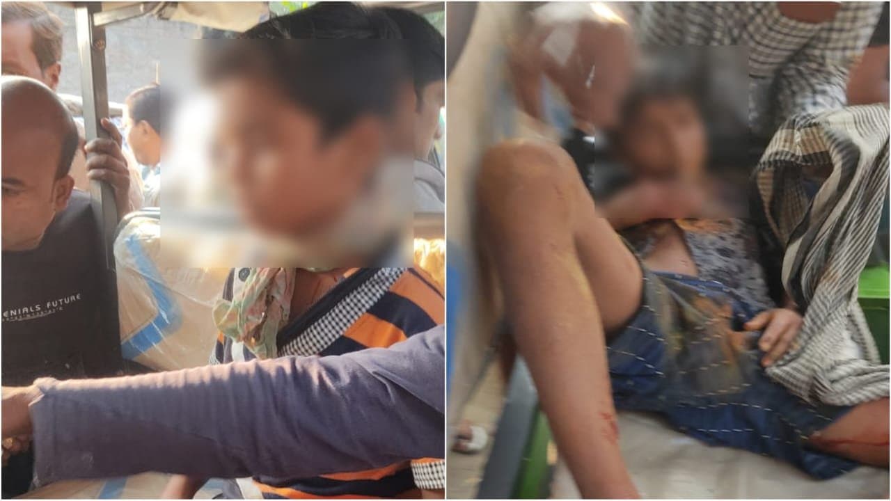 মুর্শিদাবাদে বোমা বিস্ফোরণে আহত দুই শিশু 