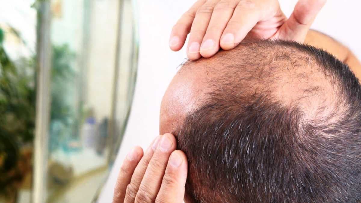 Avocado Health Benefits to Reduce Hair fall