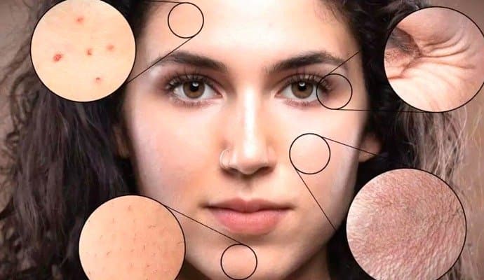 Skin Care: নির্জীব ত্বক? অতিরিক্ত মদ্যপানের ফল নয়তো? কী বলছেন থেরাপিস্ট?