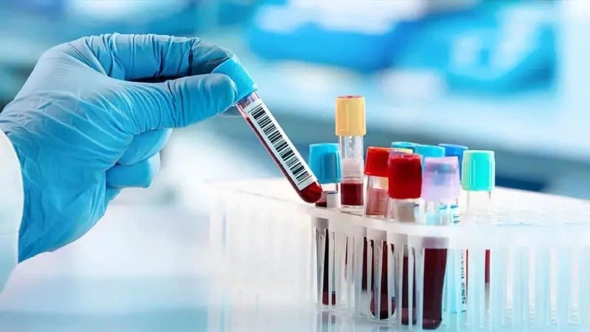 Japan creates artificial purple blood which can be given anyone