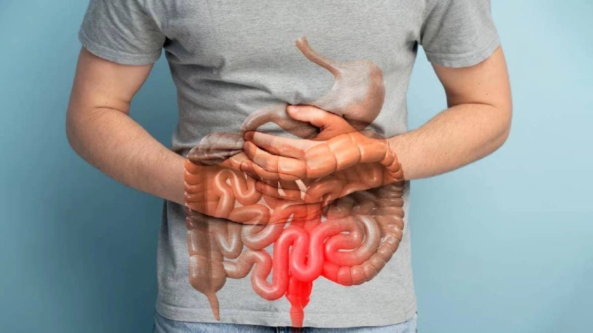 Increasing trend of colon cancer among youth