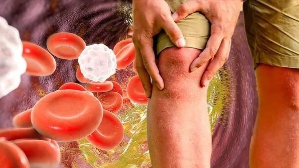  These Signs of high cholesterol appear only when you walk 